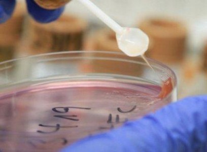 A fost solutionata alerta privind prezenta virusului hepatic A in fructe de padure cu origine Romania