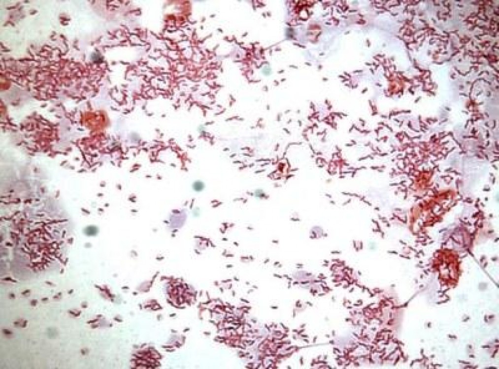 Medicii veterinari monitorizeaza o bacterie periculoasa, prezenta in carnea de pasare
