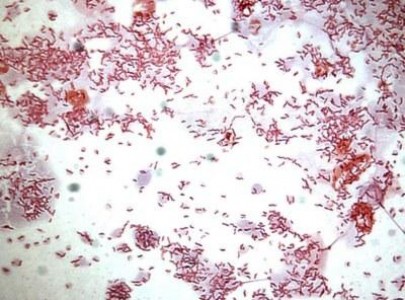 Medicii veterinari monitorizeaza o bacterie periculoasa, prezenta in carnea de pasare