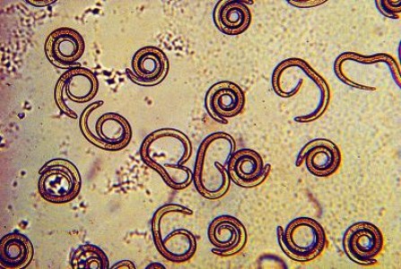 Trichineloza in Romania. 10 cazuri, doar in Satu Mare